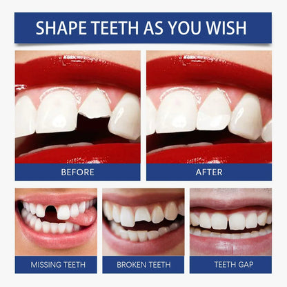 Resin Tooth Repair Glue Shapeable Teeth Gaps Filling Solid Glue Temporary Tooth Repair Safe DIY Emergency Dental Care Supplies
